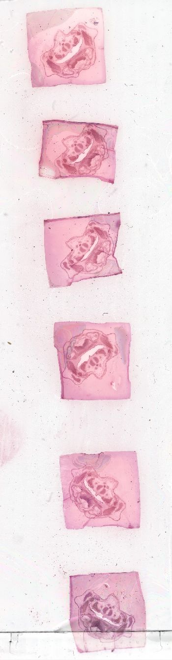 Media type: image; Special Collections 3992   shows specimen_part histological serial section;